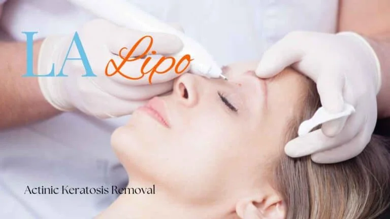 Woman receiving Actinic Keratosis Removal Treatment Kingsbury