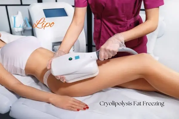 Woman receiving coolsculpting Kingsbury treatment on her thighs