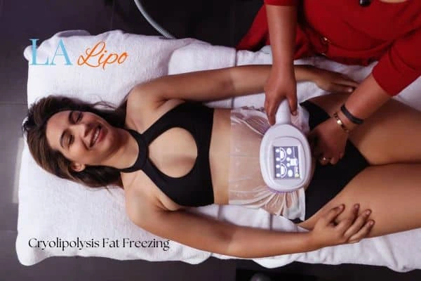 woman getting cryolipolysis Kingsbury