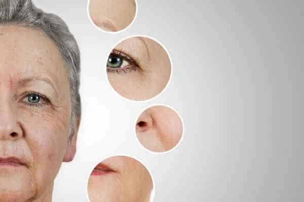 HIFU Facelift Kingsbury from LA LIPO
