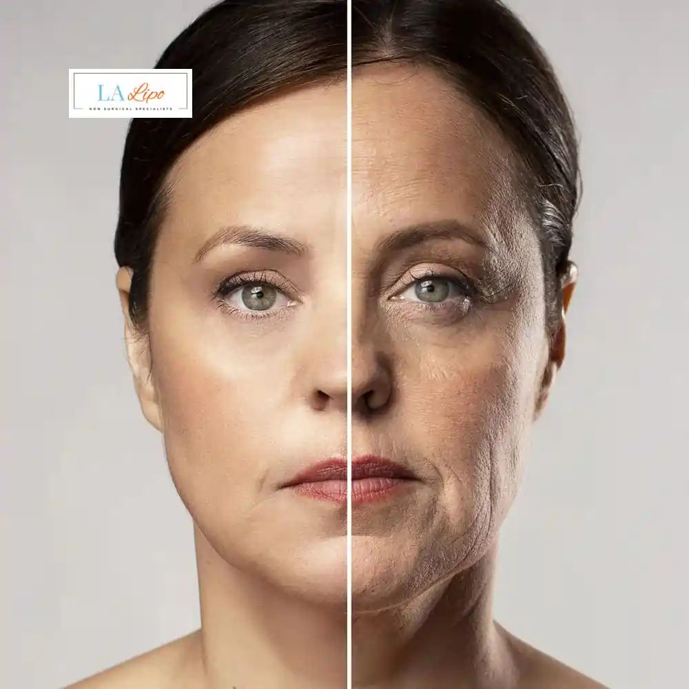 How Can You Tell If Non-Surgical Skin Tightening Is Right for You Kingsbury?
