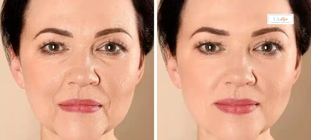 How Long Does It Take to See Results and How Long Do They Last Kingsbury?