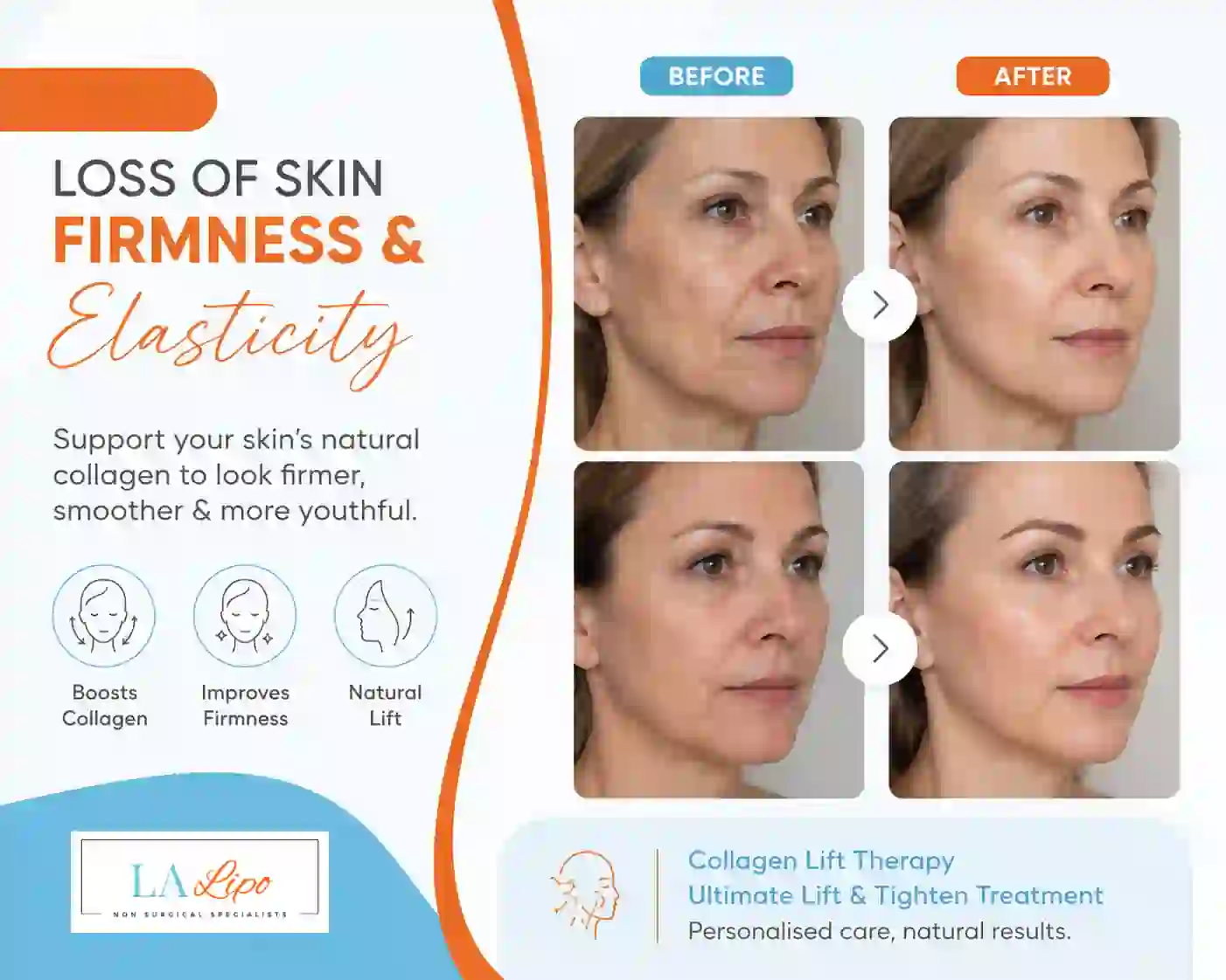 Sign #7: Loss of Skin Firmness and Elasticity Kingsbury
