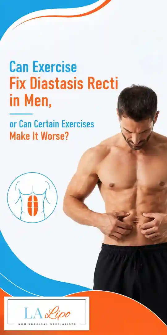 Can Exercise Fix Diastasis Recti in Men, or Can Certain Exercises Make It Worse Kingsbury?